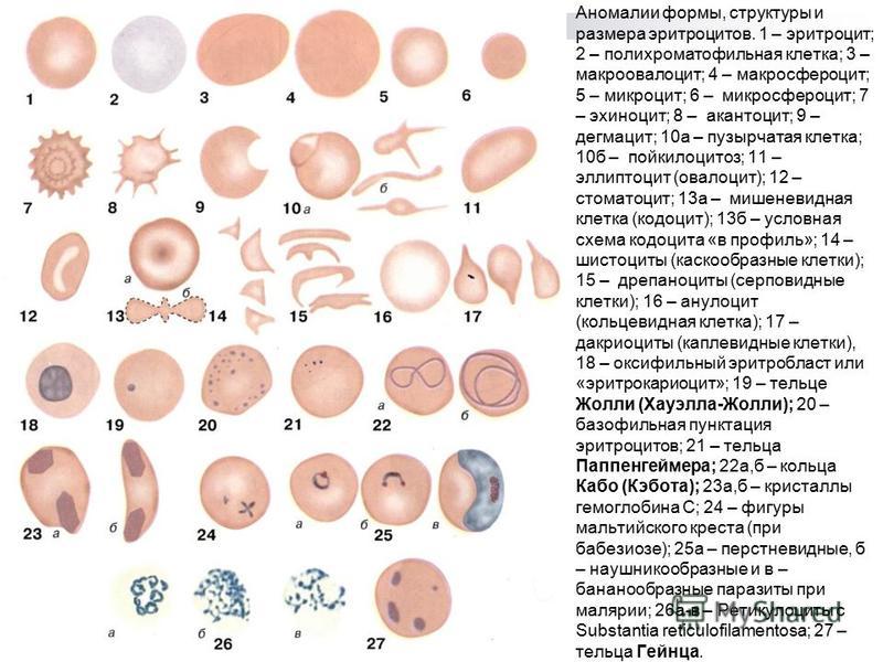 Аномалии формы, структуры и размера эритроцитов. 1 – эритроцит; 2 – полихроматофильная клетка; 3 – макроовалоцит; 4 – микросфероцит; 5 – микроцит; 6 – микросфероцит; 7 – эхиноцит; 8 – акантоцит; 9 – дегмацит; 10 а – пузырчатая клетка; 10 б – пойкилоц
