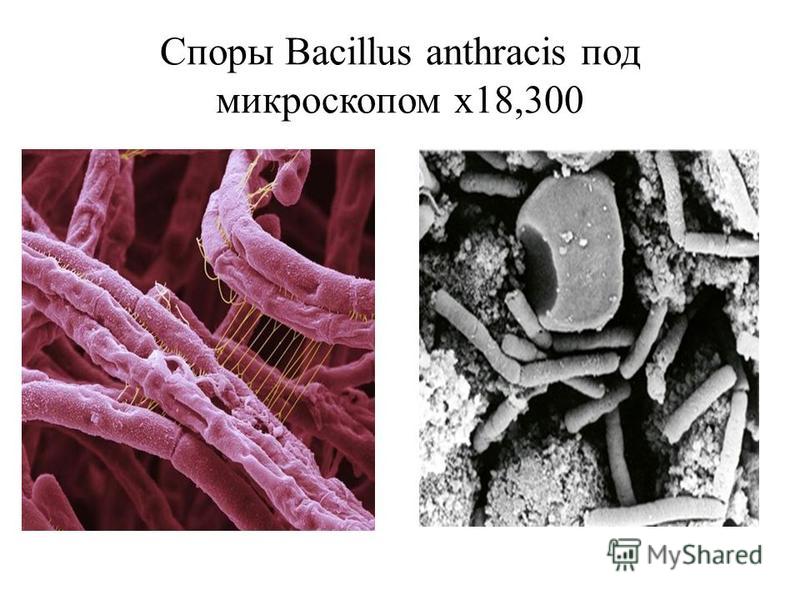 Споры Вacillus anthracis под микроскопом x18,300