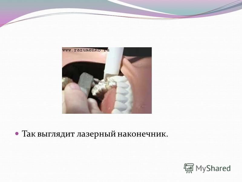 Реферат: Лазеротерапия в терепавтической стоматологии
