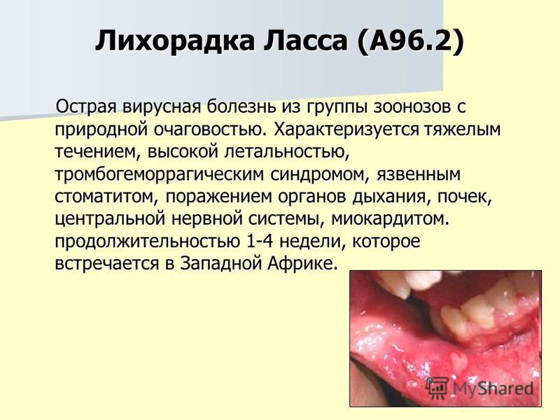 Лихорадка Ласса (А96.2) Острая вирусная болезнь из группы зоонозов с природной очаговостью. Характеризуется тяжелым течением, высокой летальностью, тромбогеморрагическим синдромом, язвенным стоматитом, поражением органов дыхания, почек, центральной н