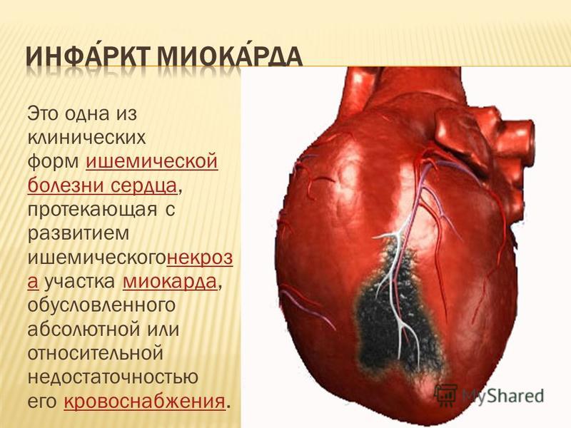 Это одна из клинических форм ишемической болезни сердца, протекающая с развитием ишемического некроза участка миокарда, обусловленного абсолютной или относительной недостаточностью его кровоснабжения.ишемической болезни сердца некроза миокарда кровос