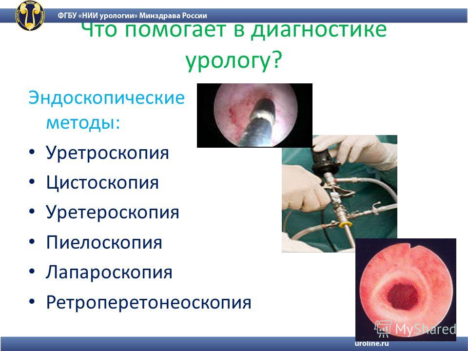 Ультразвуковая Диагностика Предстательной Железы Назаренко Бесплатно