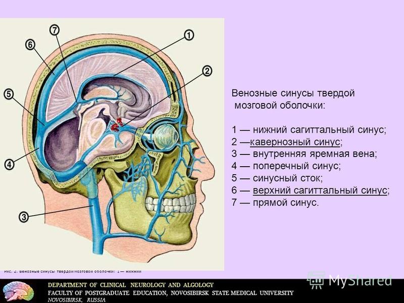 DEPARTMENT OF CLINICAL NEUROLOGY AND ALGOLOGY FACULTY OF POSTGRADUATE EDUCATION, NOVOSIBIRSK STATE MEDICAL UNIVERSITY NOVOSIBIRSK, RUSSIA Рис. 2. Венозные синусы твердой мозговой оболочки: 1 нижний Венозные синусы твердой мозговой оболочки: 1 нижний 