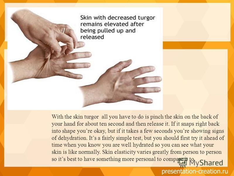 With the skin turgor all you have to do is pinch the skin on the back of your hand for about ten second and then release it. If it snaps right back into shape youre okay, but if it takes a few seconds youre showing signs of dehydration. Its a fairly 