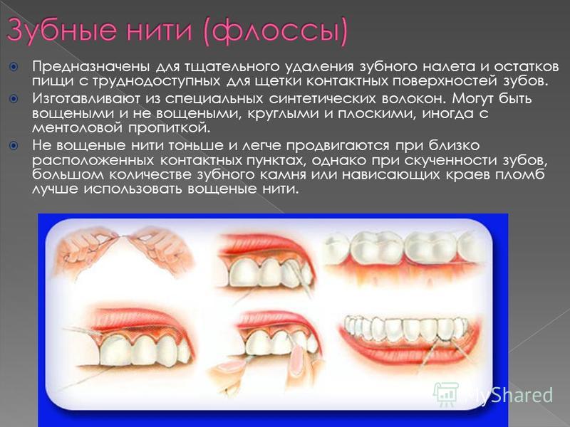 Предназначены для тщательного удаления зубного налета и остатков пищи с труднодоступных для щетки контактных поверхностей зубов. Изготавливают из специальных синтетических волокон. Могут быть вощеными и не вощеными, круглыми и плоскими, иногда с мент