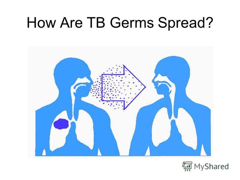 How Are TB Germs Spread?