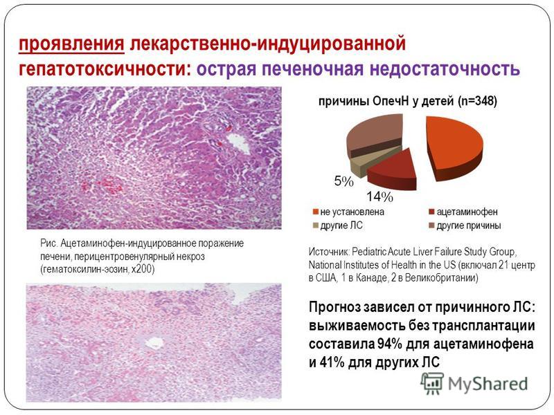 Презентация на тему острая печеночная недостаточность