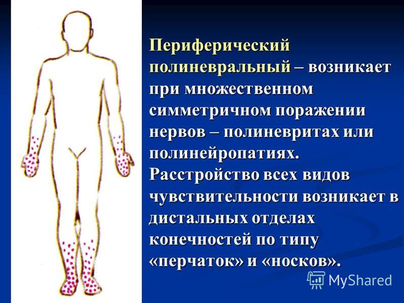 Периферический полиневральный – возникает при множественном симметричном поражении нервов – полиневритах или полинейропатиях. Расстройство всех видов чувствительности возникает в дистальных отделах конечностей по типу «перчаток» и «носков».