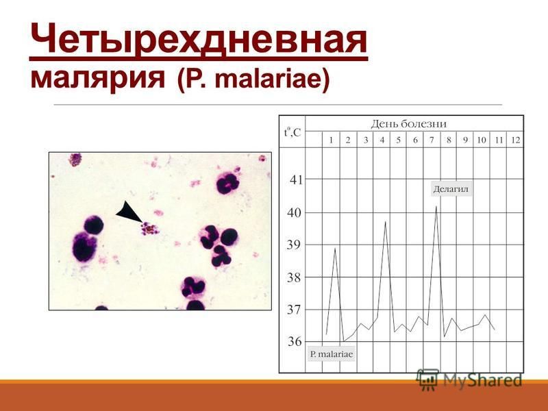 Четырехдневная малярия (P. malariae)