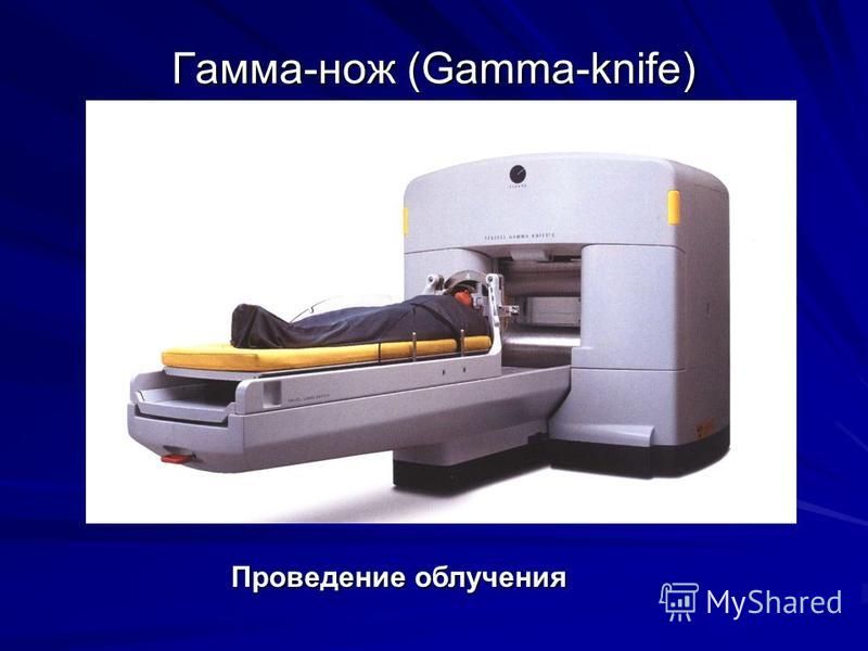 Гамма-нож (Gamma-knife) Проведение облучения