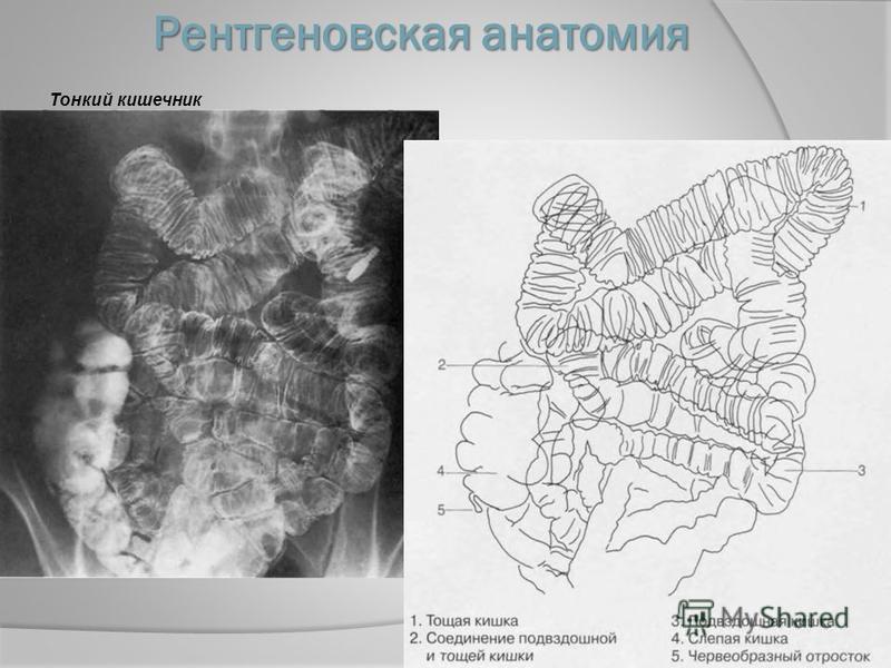 Рентгеновская анатомия Тонкий кишечник