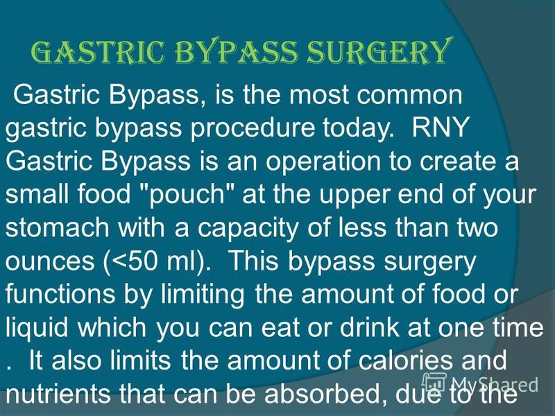 Gastric Bypass surgery Gastric Bypass, is the most common gastric bypass procedure today. RNY Gastric Bypass is an operation to create a small food 