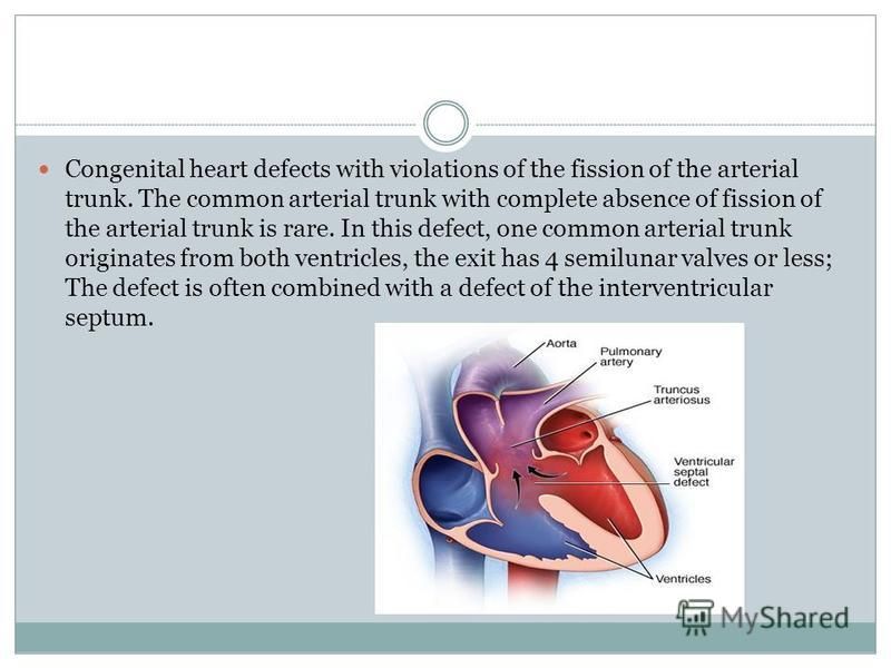 Congenital heart defects with violations of the fission of the arterial trunk. The common arterial trunk with complete absence of fission of the arterial trunk is rare. In this defect, one common arterial trunk originates from both ventricles, the ex