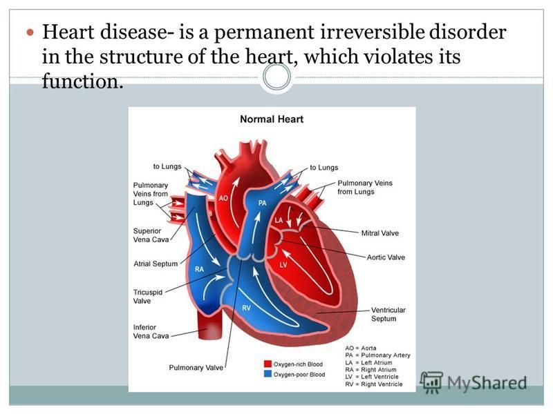 Heart disease- is a permanent irreversible disorder in the structure of the heart, which violates its function.