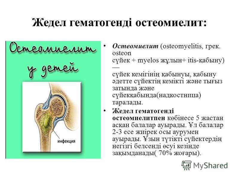 Жедел гематогенді остеомиелит: Остеомиелит (osteomyelitis, грек. osteon сүйек + myelos жұлын+ itis-қабыну) сүйек кемігінің қабынуы, қабыну әдетте сүйектің кемікті және тығыз затында және сүйекқабында(надкостница) тара лады. Жедел гематогенді остеомие