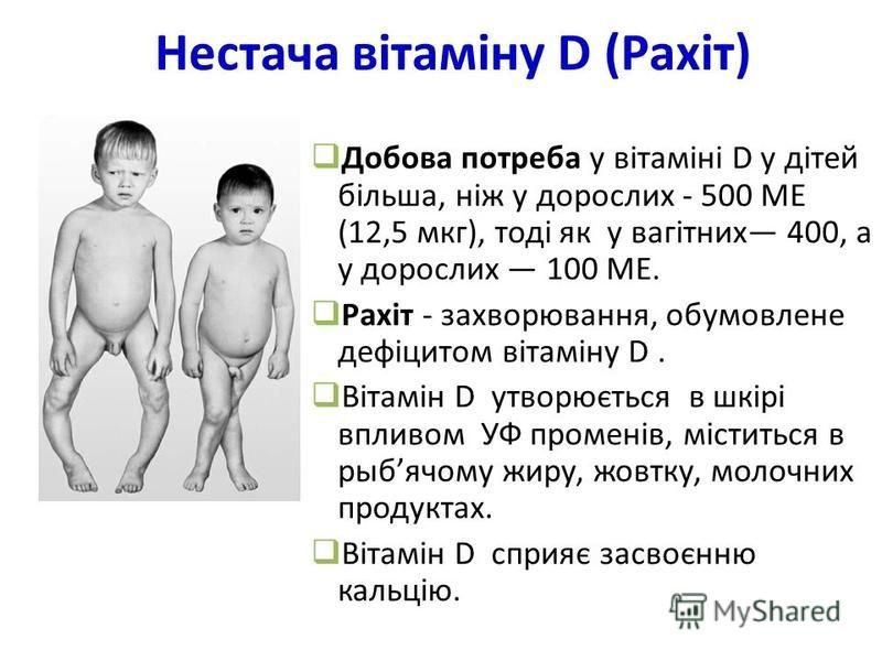 Нестача вітаміну D (Рахіт) Добова потреба у вітаміні D у дітей більша, ніж у дорослих - 500 ME (12,5 мкг), тоді як у вагітних 400, а у дорослих 100 ME. Рахіт - захворювання, обумовлене дефіцитом вітаміну D. Вітамін D утворюється в шкірі впливом УФ пр