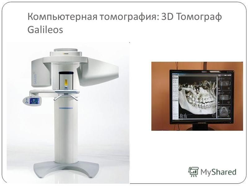 Компьютерная томография : 3D Томограф Galileos