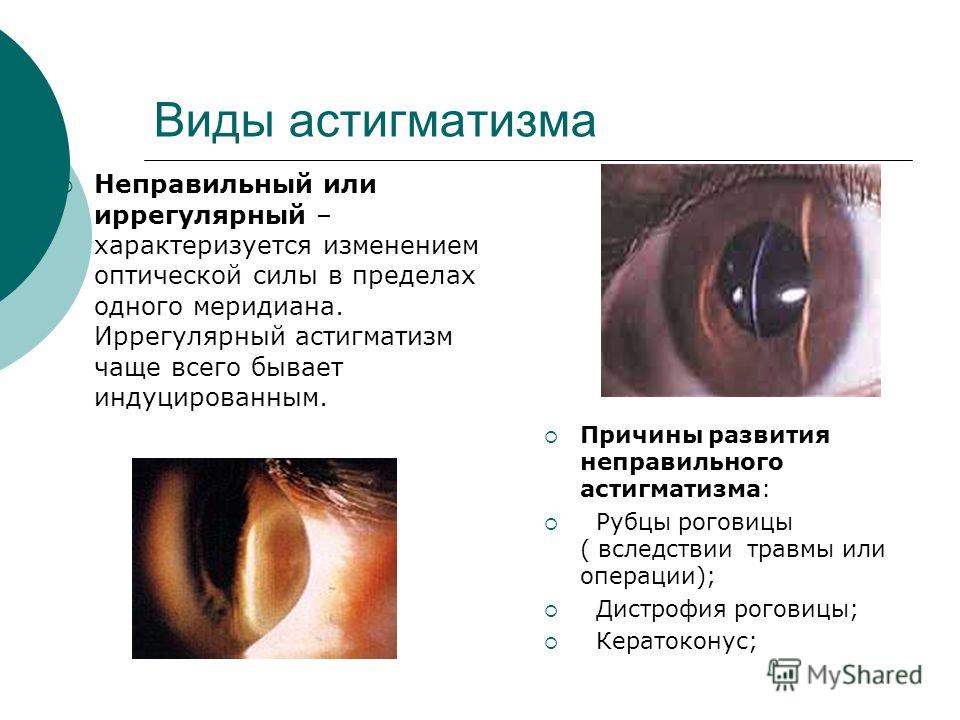 Техники восстановление зрения