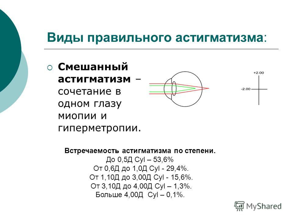 Очки для зрения формы кошачий глаз