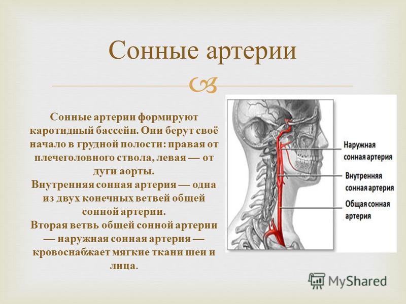 Где Находится Сонная Артерия У Человека Фото