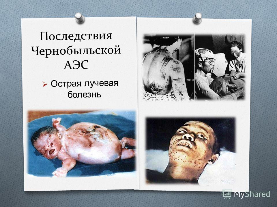 Какие болезни бывают молочной железы