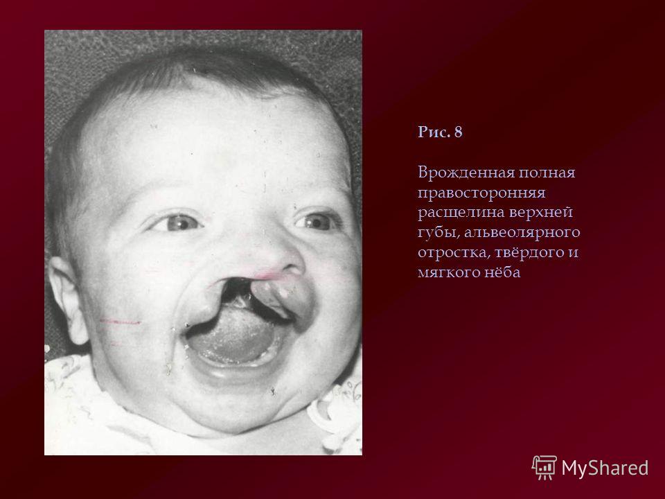 Как сделать потолок из гипсокартона своими руками Журнал "Магия и красота" ВКонтакте