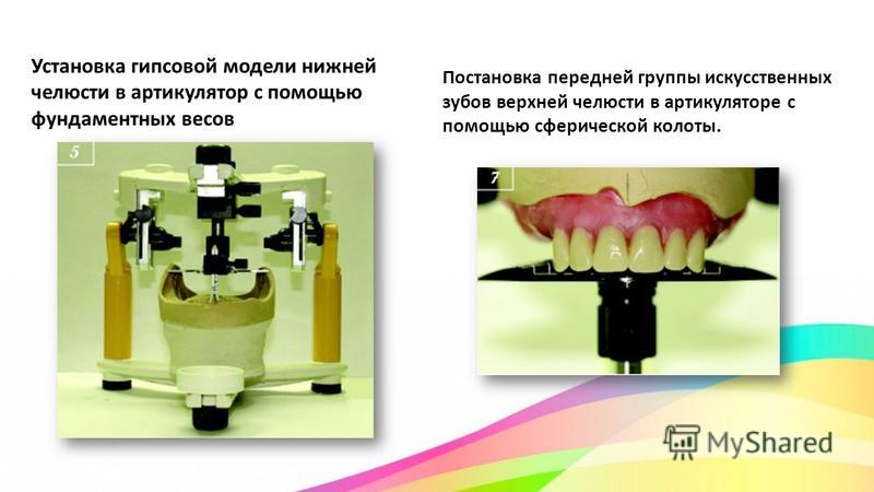 Постановка по стеклу