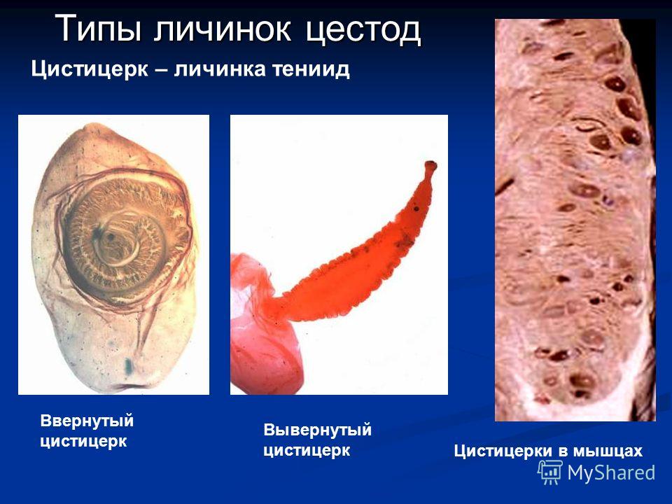 презентация черви паразиты человека презентация черви паразиты человека