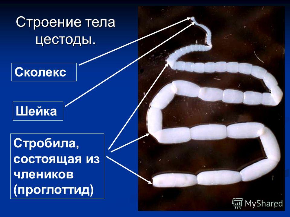 ленточные черви у человека ленточные черви у человека