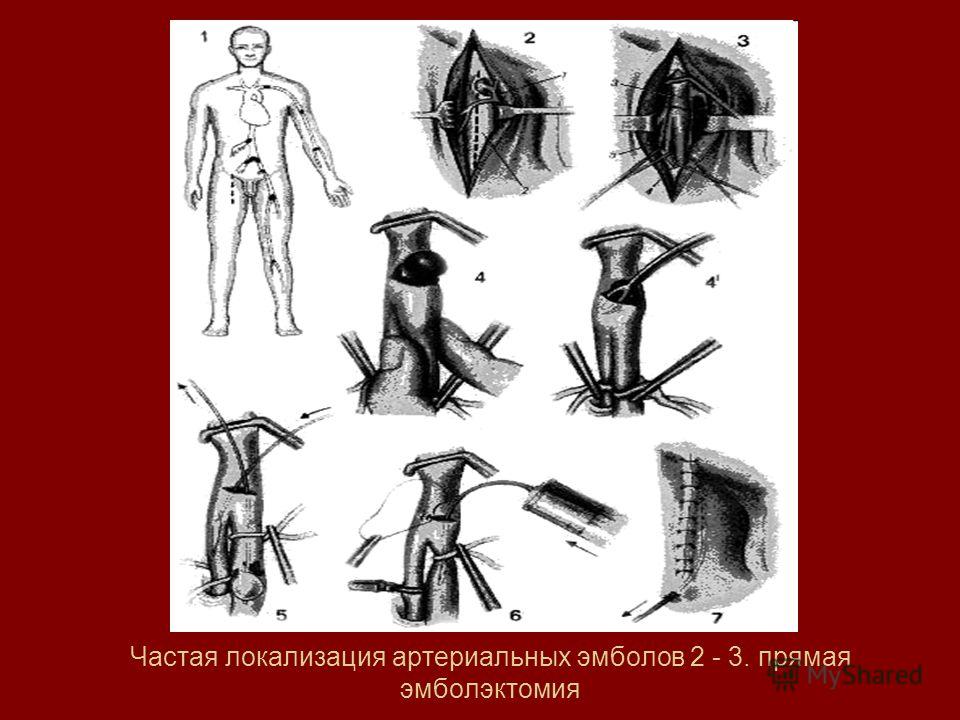 Из за частых мастурбаций может болеть яичко