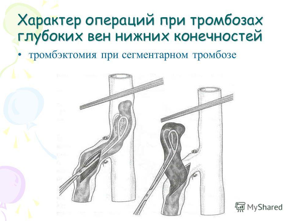 Лечение связок колена препараты