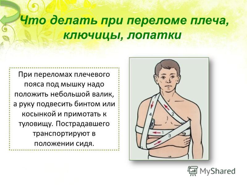 Переломы ключицы презентация