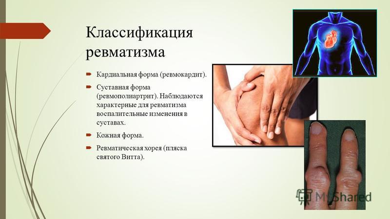 Диета при ревматизме и артрозе. Долгит (Dolgit) — статьи о применении препарата при травмах, ушибах. Что есть при артрозе суставов — какая диета подойдет лучше всего. Диета при подагре и повышенной мочевой кислоте: что можно и что нельзя