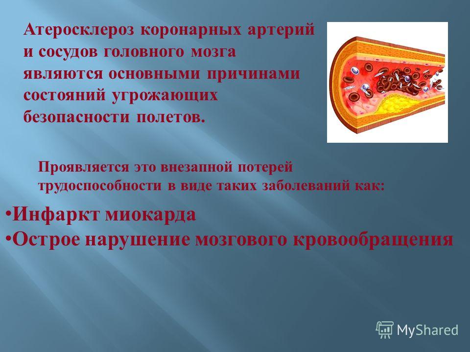 Лечение атеросклероза сосудов головного мозга в домашних условиях Лечение атеросклероза сосудов головного мозга в домашних условиях