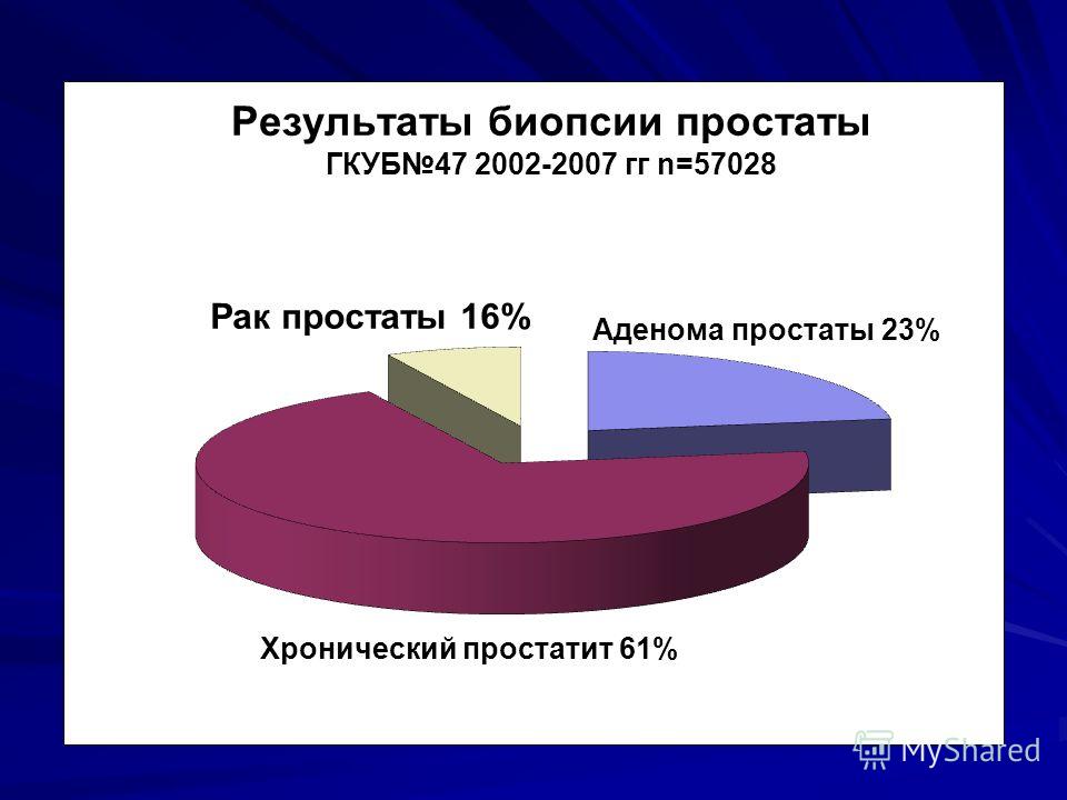 При пальцевом ректальном исследовании аденома предстательной железы