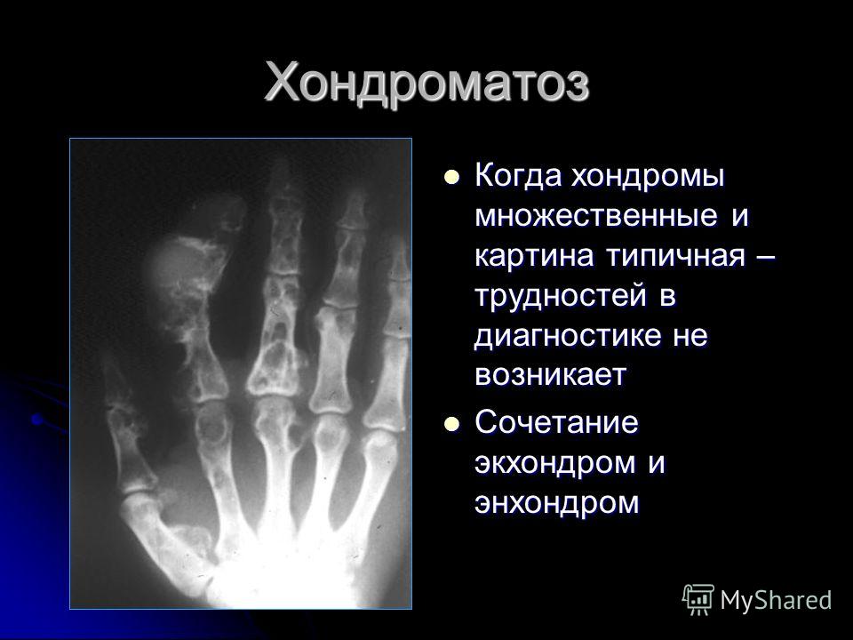 Что делать если был прострел в пояснице Что делать если был прострел в пояснице