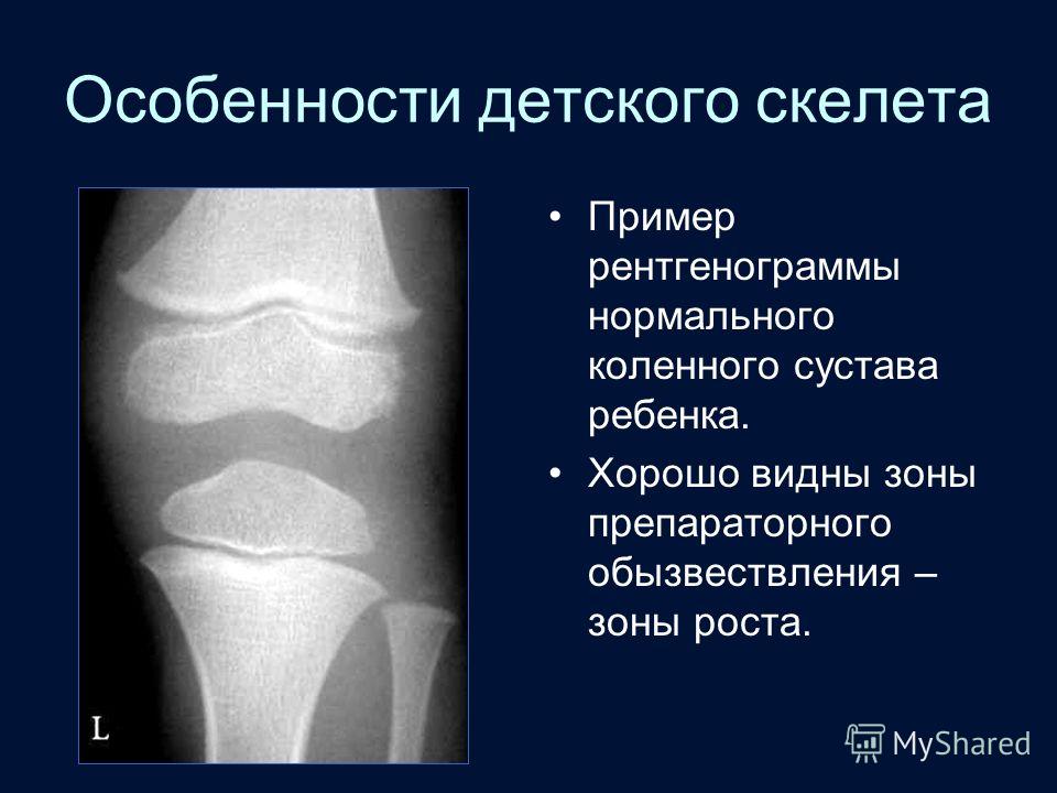 foto Народное лечение — от болей в суставах стопы избавление изображения photo Народное лечение — от болей в суставах стопы избавление изображения