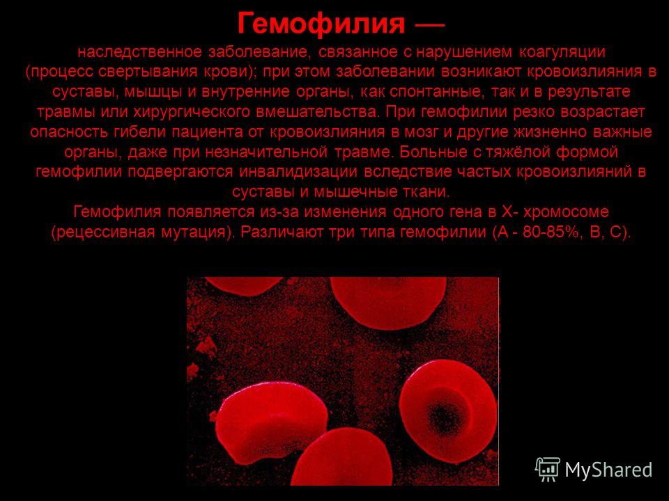 Наследственные заболевания связанные с кровью Наследственные заболевания связанные с кровью