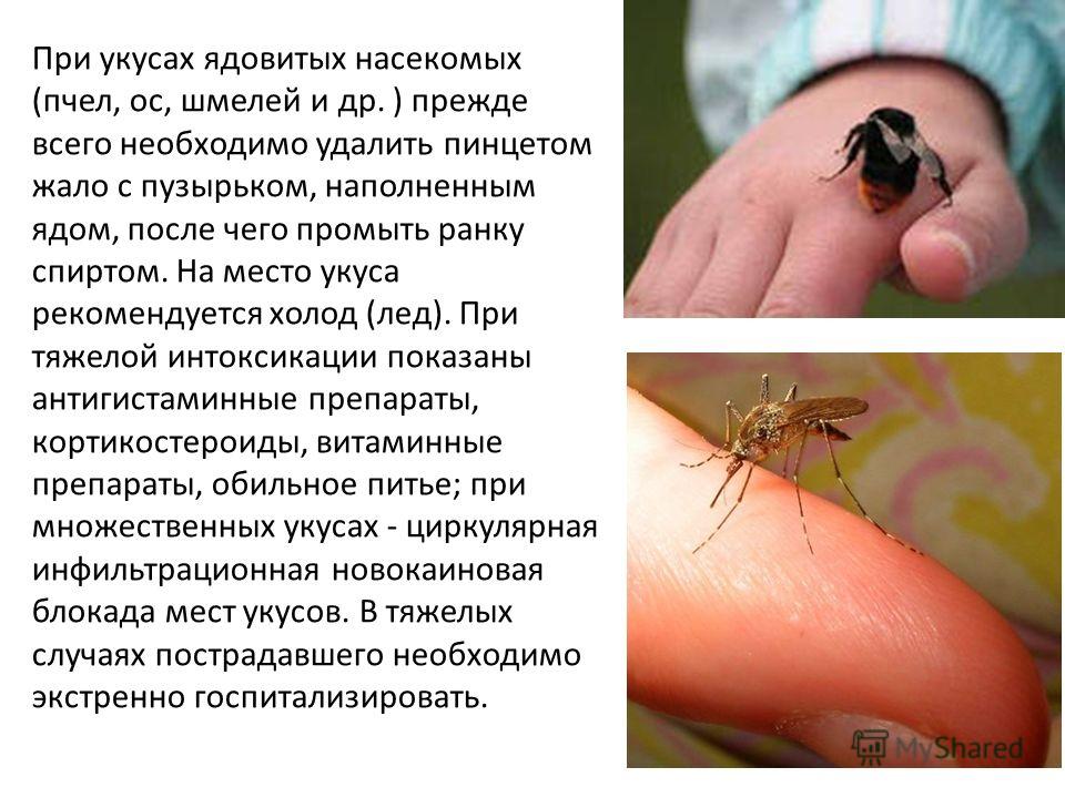 При укус осы что делать в домашних условиях При укус осы что делать в домашних условиях