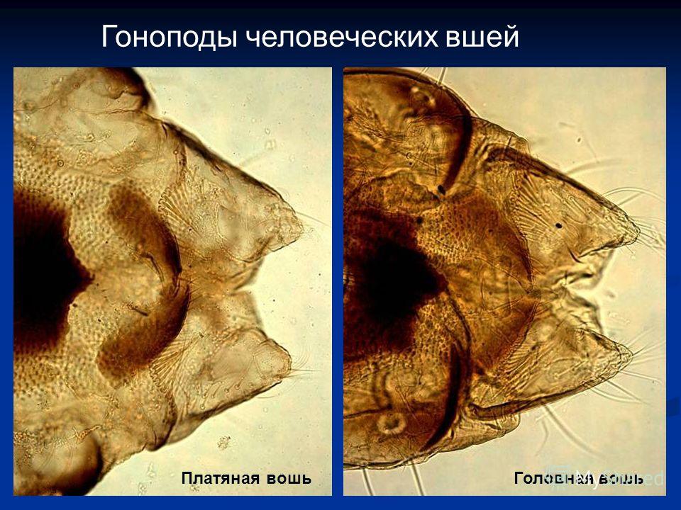 членистоногие паразиты человека членистоногие паразиты человека