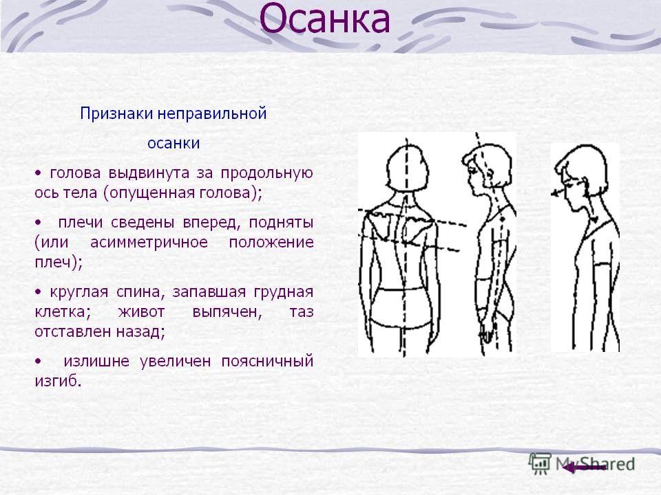 Типы осанки и описание
