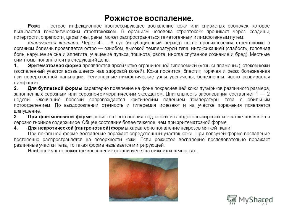 САПР Грация - m Прыщи - Зуд и прыщи на пальцах рук Как избавиться от прыщей