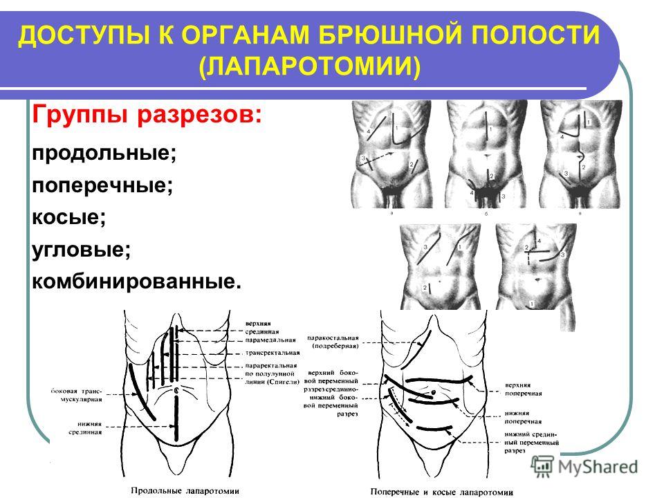 [PUNIQRANDLINE-(au-dating-names.txt) 58 Передняя брюшная стенка реферат 1364