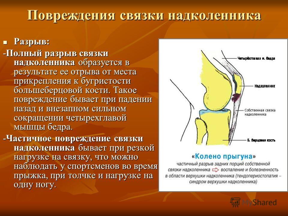 Ушиб коленных суставов код по мкб 10 Ушиб коленных суставов код по мкб 10