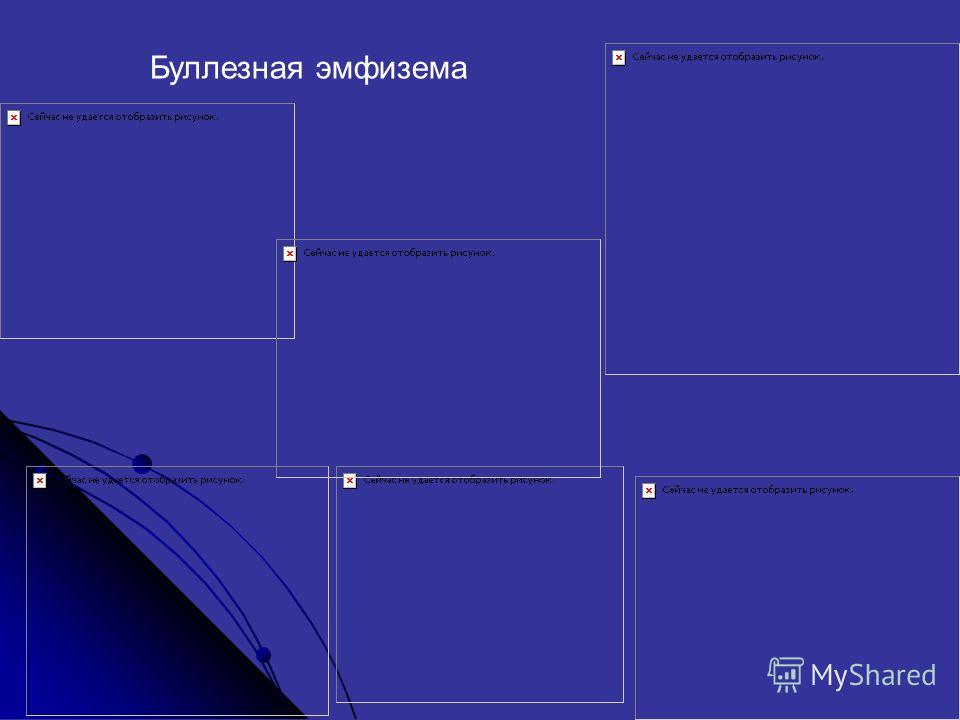Болит место на голове как синяк