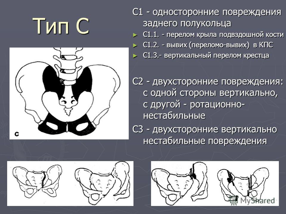 Предвестники родов у повторнородящих - Huggies Парень общается с бывшей форум