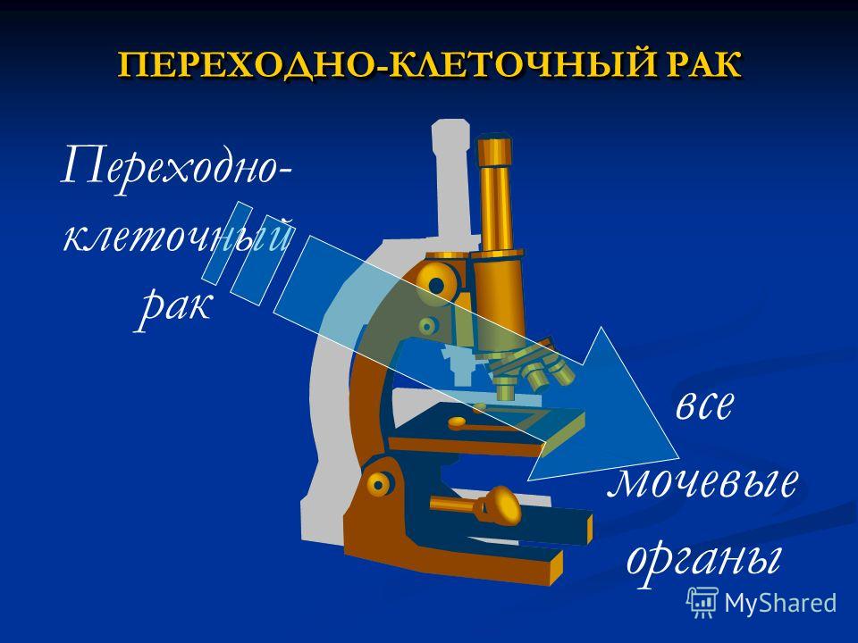 Обрезание при простатите Обрезание при простатите