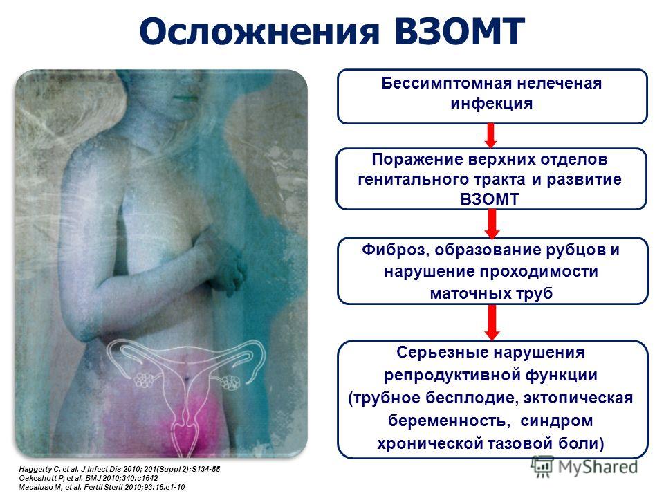 Симптомы воспалительных заболеваний в гинекологии