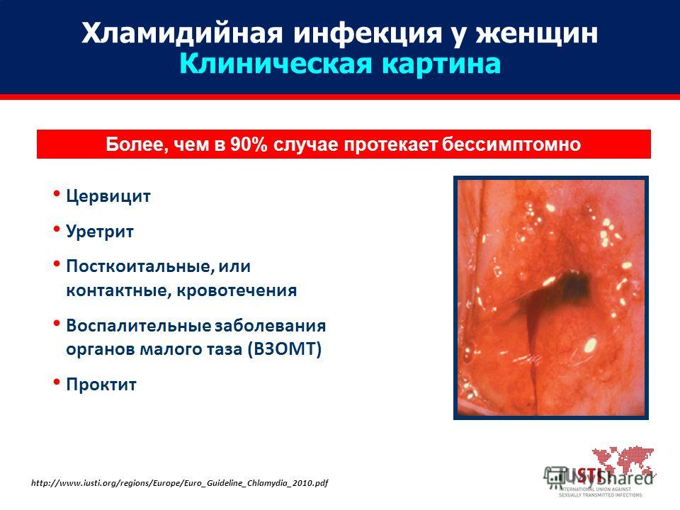 Голая Юля Куварзина (актриса) видно её сиськи, киску