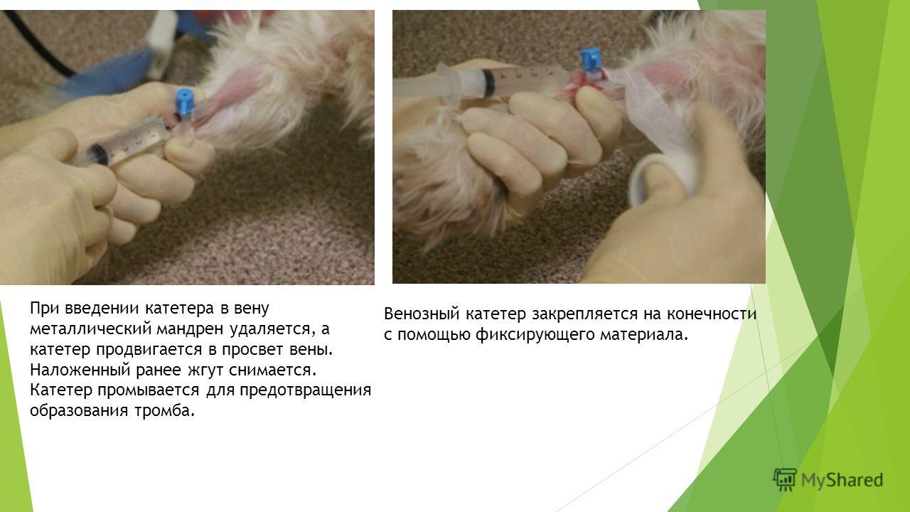 Кровотечение из варикозно расширенных вен пищевода лечение
